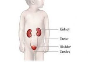 Pediatric-Urology.jpg
